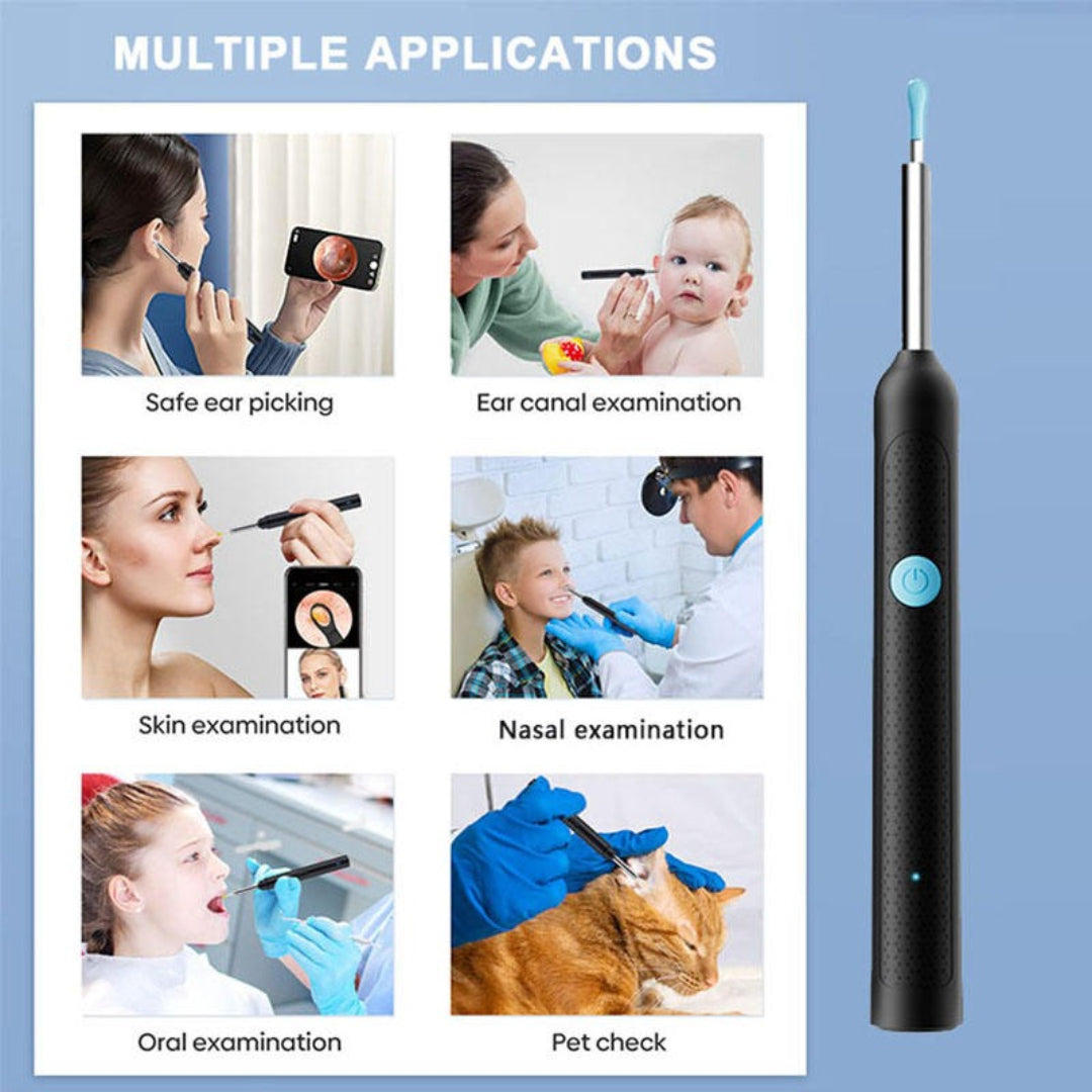 Visual Ear Wax Removal Tool, Earwax Remover Tool with 1080P HD Camera
